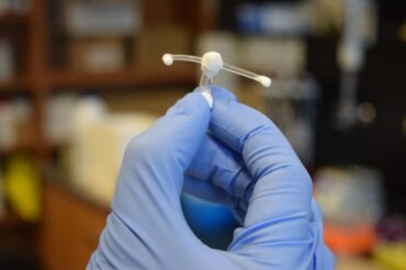 Sida : un implant vaginal pour protéger les femmes du VIH