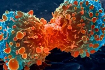 Des scientifiques découvrent comment recruter et reprogrammer des cellules de la peau pour lutter contre le cancer