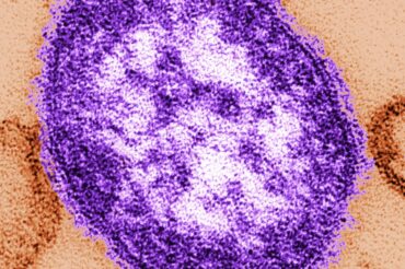 A new study on measles reveals a scary side effect: “immune-system amnesia”