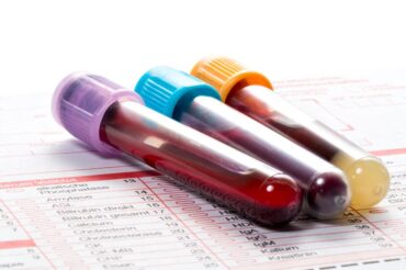Standard blood test can predict risk of dying from Covid-19