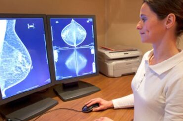 Breast cancer surpasses lung cancer as leading cancer diagnosis worldwide