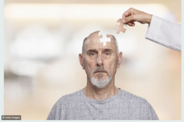 Alzheimer: bientôt un nouveau médicament pour lutter contre le déclin cognitif?