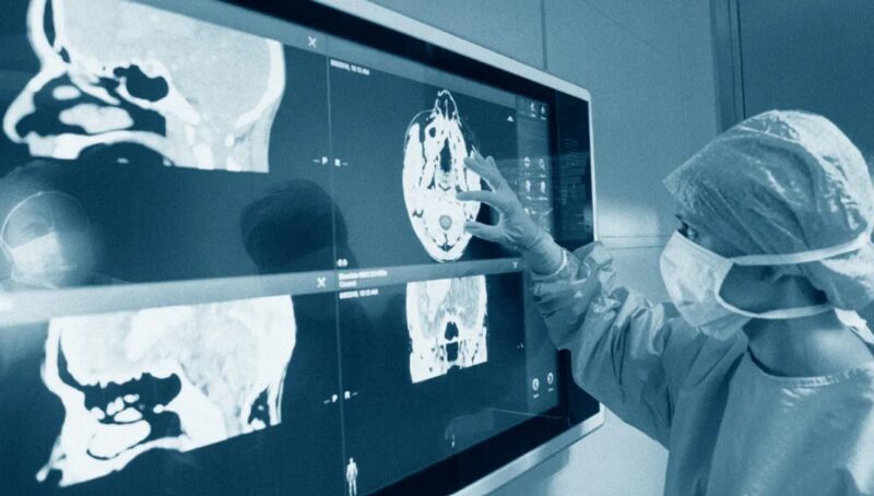 Cause Of Neurological COVID 19 Symptoms Explored Clinique CME