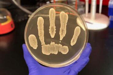 Common human skin bacteria could protect against cancer, say researchers