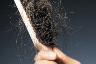 How much hair loss is normal ? And what you probably don’t know