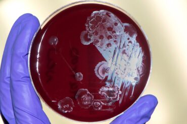 Antibiotics weren’t used to cure these patients, fecal bacteria were