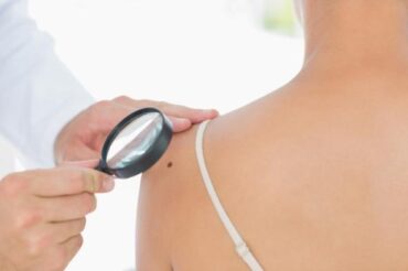 Quebec woman must wait months or years for dermatologist to follow-up on skin cancer