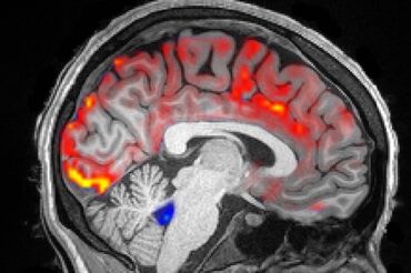 How deep sleep may help the brain clear Alzheimer’s toxins