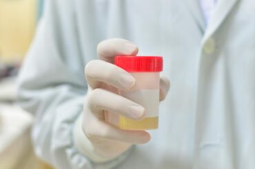 Prostate cancer: home urine test could ‘revolutionize diagnosis’