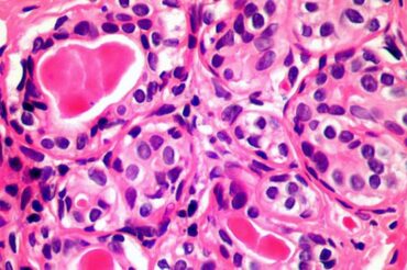 Cette cellule de notre sang pour­rait nous aider à soigner tous les cancers