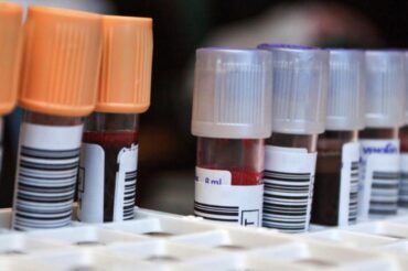 Des patients guéris de la COVID-19 seront sollicités pour faire don de leur sang