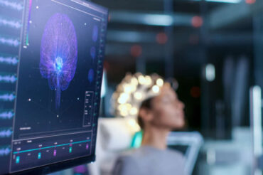 Scans show covid-19 patients experience wide variety of brain abnormalities