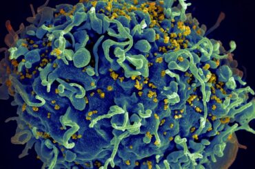 Oxford University researchers start trial for HIV vaccine