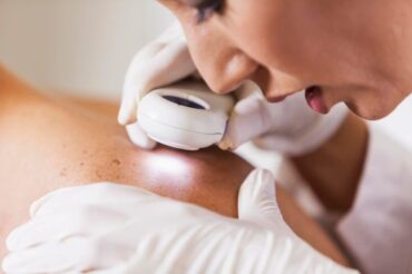 New gel treatment shows promise for skin cancer