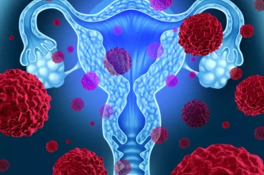 McGill contribue à un nouveau test pour les cancers de l’ovaire et de l’utérus