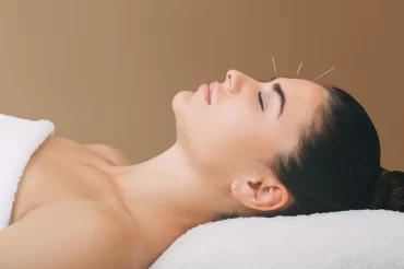 Acupuncture could reduce tension headaches by half