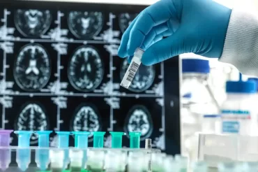 Success of experimental Alzheimer’s drug hailed as ‘historic moment’